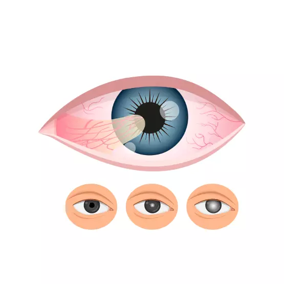การตรวจสุขภาพตาเบื้องต้น ซึ่งเป็นพื้นฐานทั้งหมดที่เกี่ยวข้องกับการมองเห็น