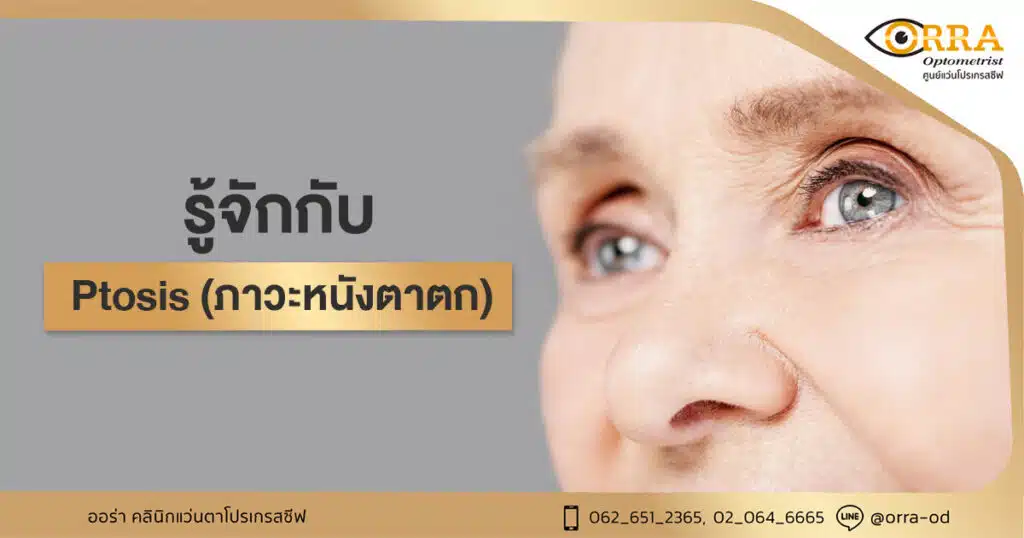 หนังตาตก