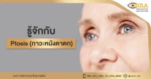 หนังตาตก