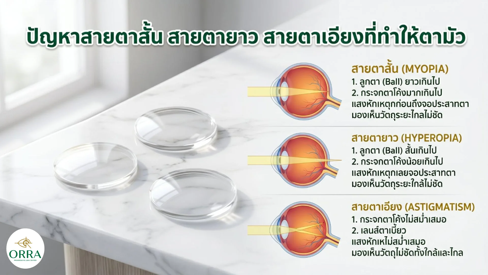 causes of blurry vision eye problems สาเหตุตามัวจากสายตาสั้น สายตายาว สายตาเอียง และลักษณะการรวมแสงของดวงตา