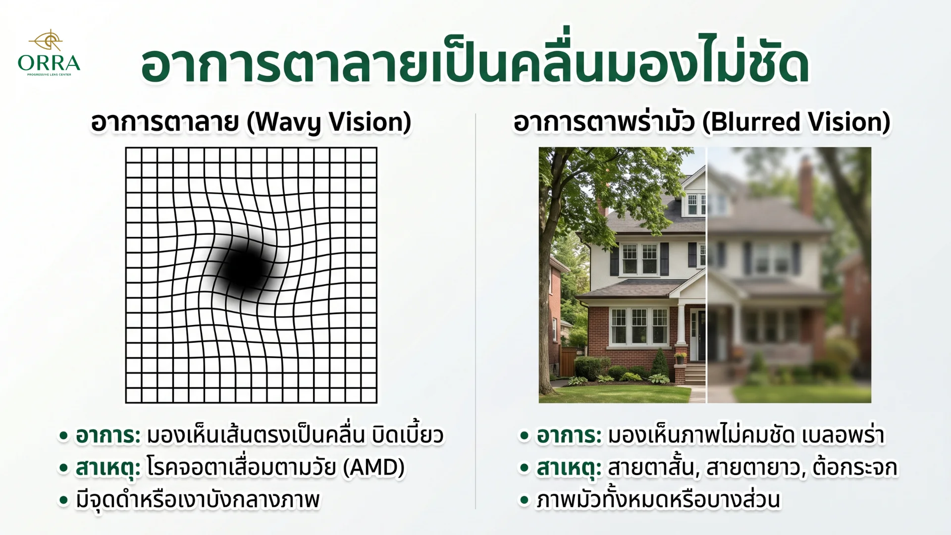 characteristics and causes of blurred vision ลักษณะอาการตามัวเกิดจากอะไรได้บ้างระหว่างโรคจอตาเสื่อมกับสายตาผิดปกติหรือต้อกระจก